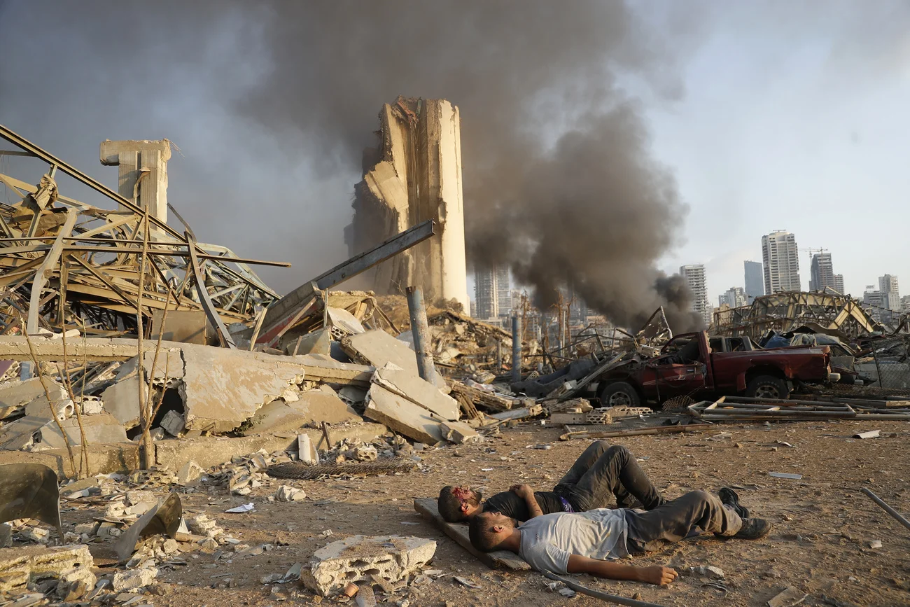 EDS NOTE: GRAPHIC CONTENT - Two injured men lie on the ground, waiting for help at the explosion scene that hit the seaport, in Beirut Lebanon, Tuesday, Aug. 4, 2020. Massive explosions rocked downtown Beirut on Tuesday, flattening much of the port, damaging buildings and blowing out windows and doors as a giant mushroom cloud rose above the capital. Witnesses saw many people injured by flying glass and debris. (AP Photo/Hussein Malla) 